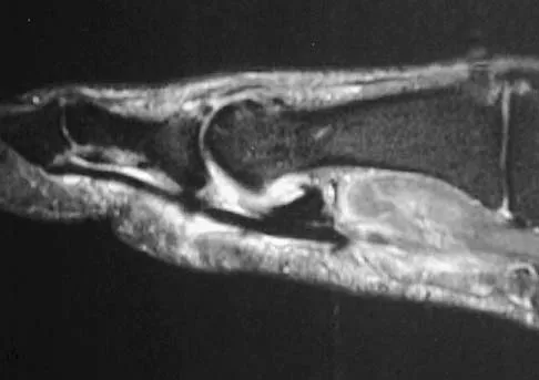 General Orthopedics 2026 Practice Questions: Set 17 (Solved) - Figure 60