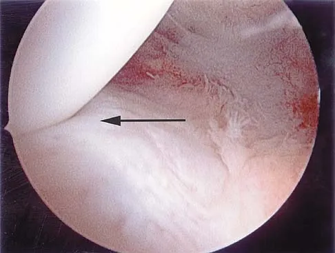 General Orthopedics 2026 Practice Questions: Set 17 (Solved) - Figure 65
