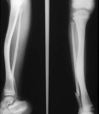 General Orthopedics 2026 Practice Questions: Set 17 (Solved) - Figure 66