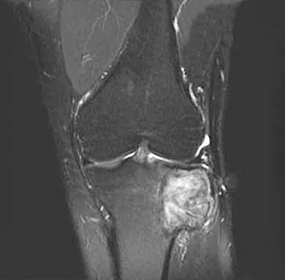 General Orthopedics 2026 Practice Questions: Set 17 (Solved) - Figure 73