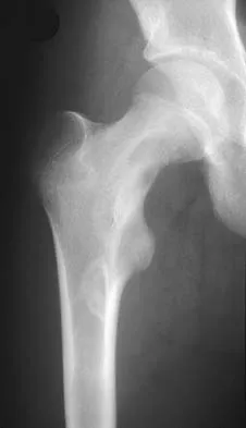 General Orthopedics 2026 Practice Questions: Set 17 (Solved) - Figure 76