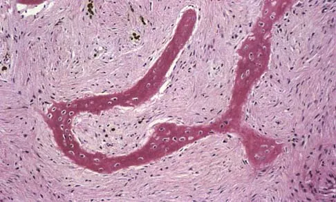 General Orthopedics 2026 Practice Questions: Set 17 (Solved) - Figure 78