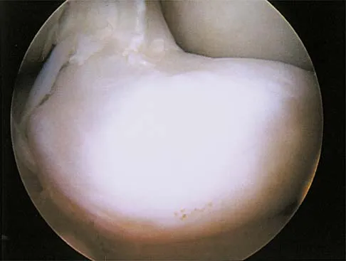 General Orthopedics 2026 Practice Questions: Set 17 (Solved) - Figure 80