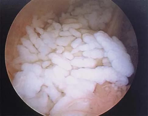 General Orthopedics 2026 Practice Questions: Set 17 (Solved) - Figure 86