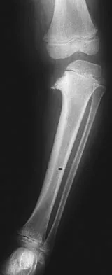 General Orthopedics 2026 Practice Questions: Set 17 (Solved) - Figure 92