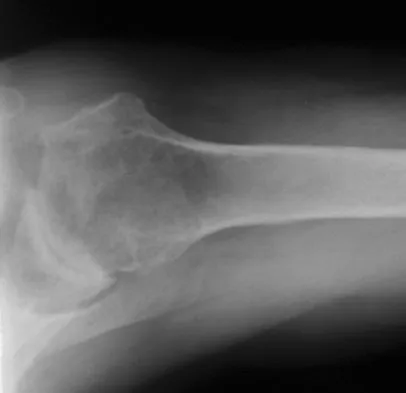 General Orthopedics 2026 Practice Questions: Set 17 (Solved) - Figure 95