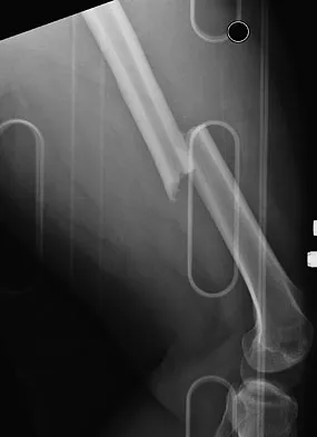 General Orthopedics Board Review 2026: High-Yield MCQs (Set 18) - Figure 101