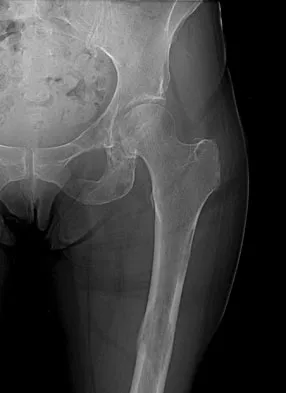 General Orthopedics Board Review 2026: High-Yield MCQs (Set 18) - Figure 106