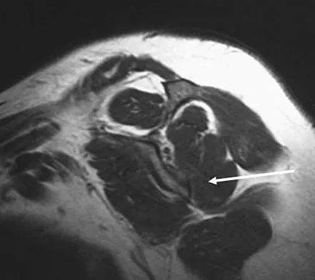 General Orthopedics Board Review 2026: High-Yield MCQs (Set 18) - Figure 115