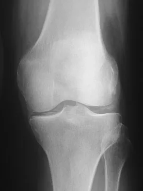 General Orthopedics Board Review 2026: High-Yield MCQs (Set 18) - Figure 120