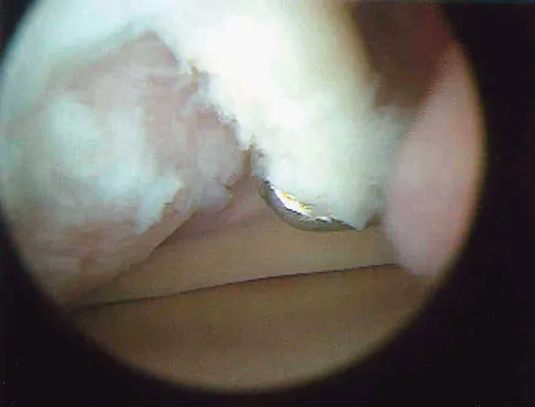 General Orthopedics Board Review 2026: High-Yield MCQs (Set 18) - Figure 121