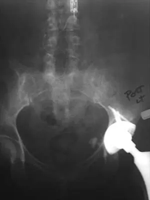 General Orthopedics Board Review 2026: High-Yield MCQs (Set 18) - Figure 129