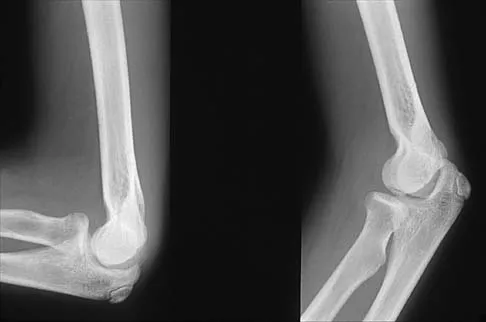 General Orthopedics Board Review 2026: High-Yield MCQs (Set 18) - Figure 13