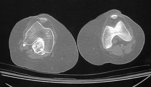 General Orthopedics Board Review 2026: High-Yield MCQs (Set 18) - Figure 131
