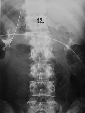 General Orthopedics Board Review 2026: High-Yield MCQs (Set 18) - Figure 16