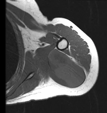 General Orthopedics Board Review 2026: High-Yield MCQs (Set 18) - Figure 26