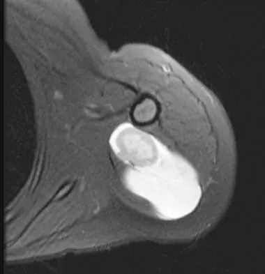 General Orthopedics Board Review 2026: High-Yield MCQs (Set 18) - Figure 27