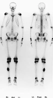 General Orthopedics Board Review 2026: High-Yield MCQs (Set 18) - Figure 30