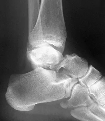 General Orthopedics Board Review 2026: High-Yield MCQs (Set 18) - Figure 34