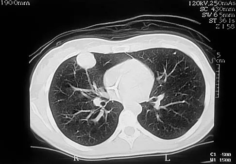 General Orthopedics Board Review 2026: High-Yield MCQs (Set 18) - Figure 38