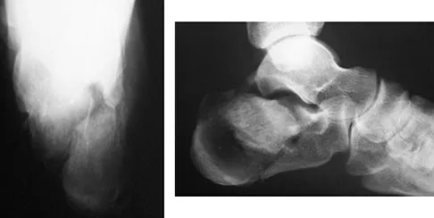 General Orthopedics Board Review 2026: High-Yield MCQs (Set 18) - Figure 41