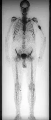 General Orthopedics Board Review 2026: High-Yield MCQs (Set 18) - Figure 43