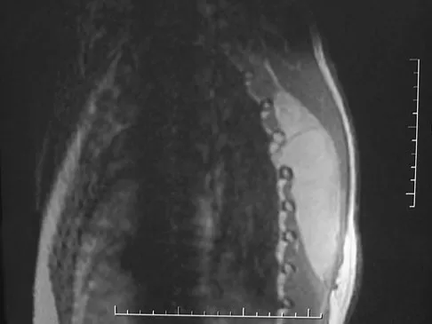 General Orthopedics Board Review 2026: High-Yield MCQs (Set 18) - Figure 54