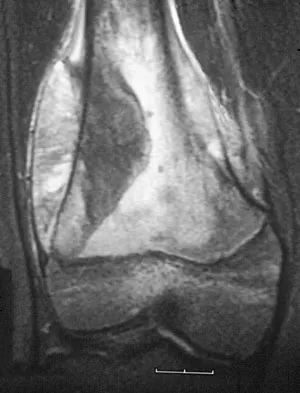 General Orthopedics Board Review 2026: High-Yield MCQs (Set 18) - Figure 57