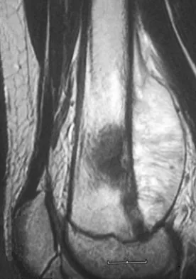 General Orthopedics Board Review 2026: High-Yield MCQs (Set 18) - Figure 58