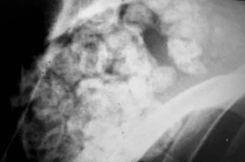 General Orthopedics Board Review 2026: High-Yield MCQs (Set 18) - Figure 67