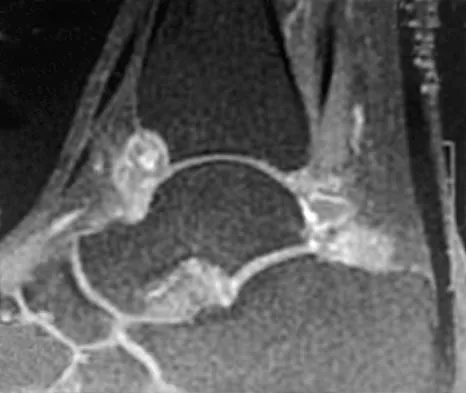 General Orthopedics Board Review 2026: High-Yield MCQs (Set 18) - Figure 68