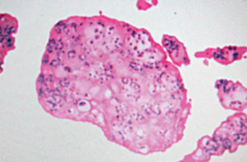 General Orthopedics Board Review 2026: High-Yield MCQs (Set 18) - Figure 70