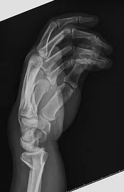 General Orthopedics Board Review 2026: High-Yield MCQs (Set 18) - Figure 71