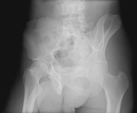 General Orthopedics Board Review 2026: High-Yield MCQs (Set 18) - Figure 74