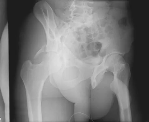 General Orthopedics Board Review 2026: High-Yield MCQs (Set 18) - Figure 75