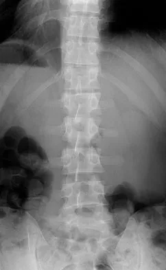 General Orthopedics Board Review 2026: High-Yield MCQs (Set 18) - Figure 79