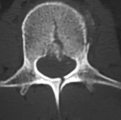 General Orthopedics Board Review 2026: High-Yield MCQs (Set 18) - Figure 82