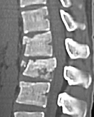 General Orthopedics Board Review 2026: High-Yield MCQs (Set 18) - Figure 83