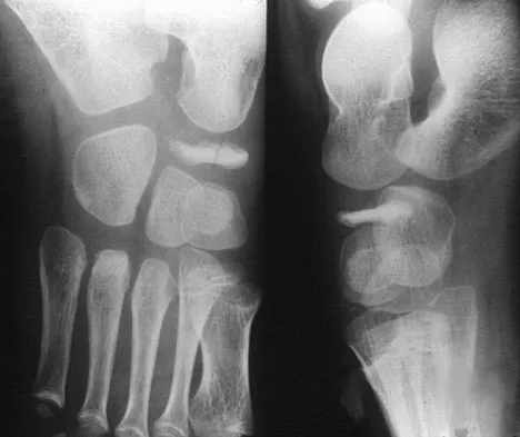 General Orthopedics Board Review 2026: High-Yield MCQs (Set 18) - Figure 9