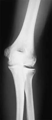 General Orthopedics Board Review 2026: High-Yield MCQs (Set 18) - Figure 91