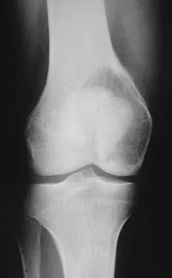 General Orthopedics Board Review 2026: High-Yield MCQs (Set 18) - Figure 94