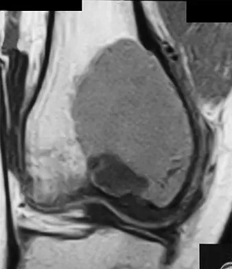 General Orthopedics Board Review 2026: High-Yield MCQs (Set 18) - Figure 96