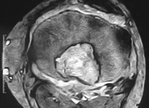 General Orthopedics 2026 Practice Questions: Set 19 (Solved) - Figure 106