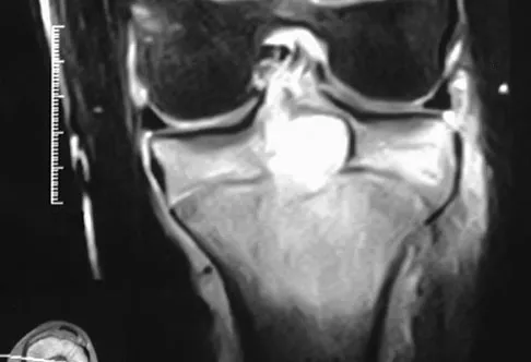 General Orthopedics 2026 Practice Questions: Set 19 (Solved) - Figure 107