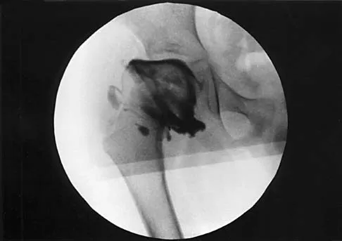General Orthopedics 2026 Practice Questions: Set 19 (Solved) - Figure 113