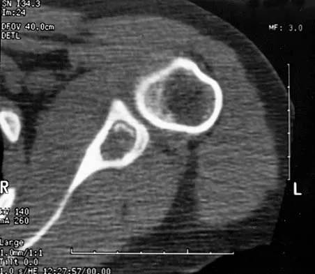 General Orthopedics 2026 Practice Questions: Set 19 (Solved) - Figure 117