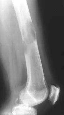 General Orthopedics 2026 Practice Questions: Set 19 (Solved) - Figure 12