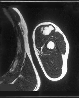 General Orthopedics 2026 Practice Questions: Set 19 (Solved) - Figure 128