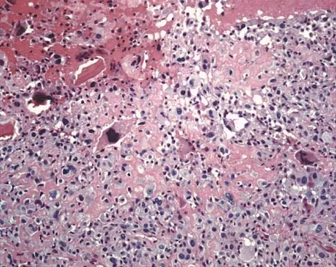 General Orthopedics 2026 Practice Questions: Set 19 (Solved) - Figure 131