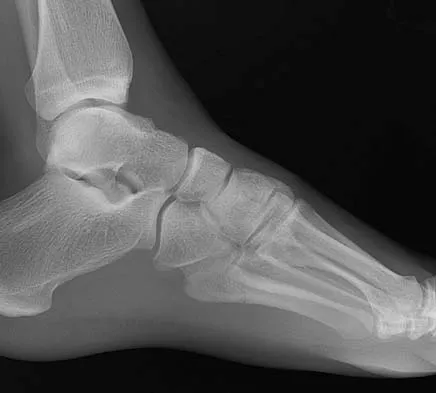 General Orthopedics 2026 Practice Questions: Set 19 (Solved) - Figure 14